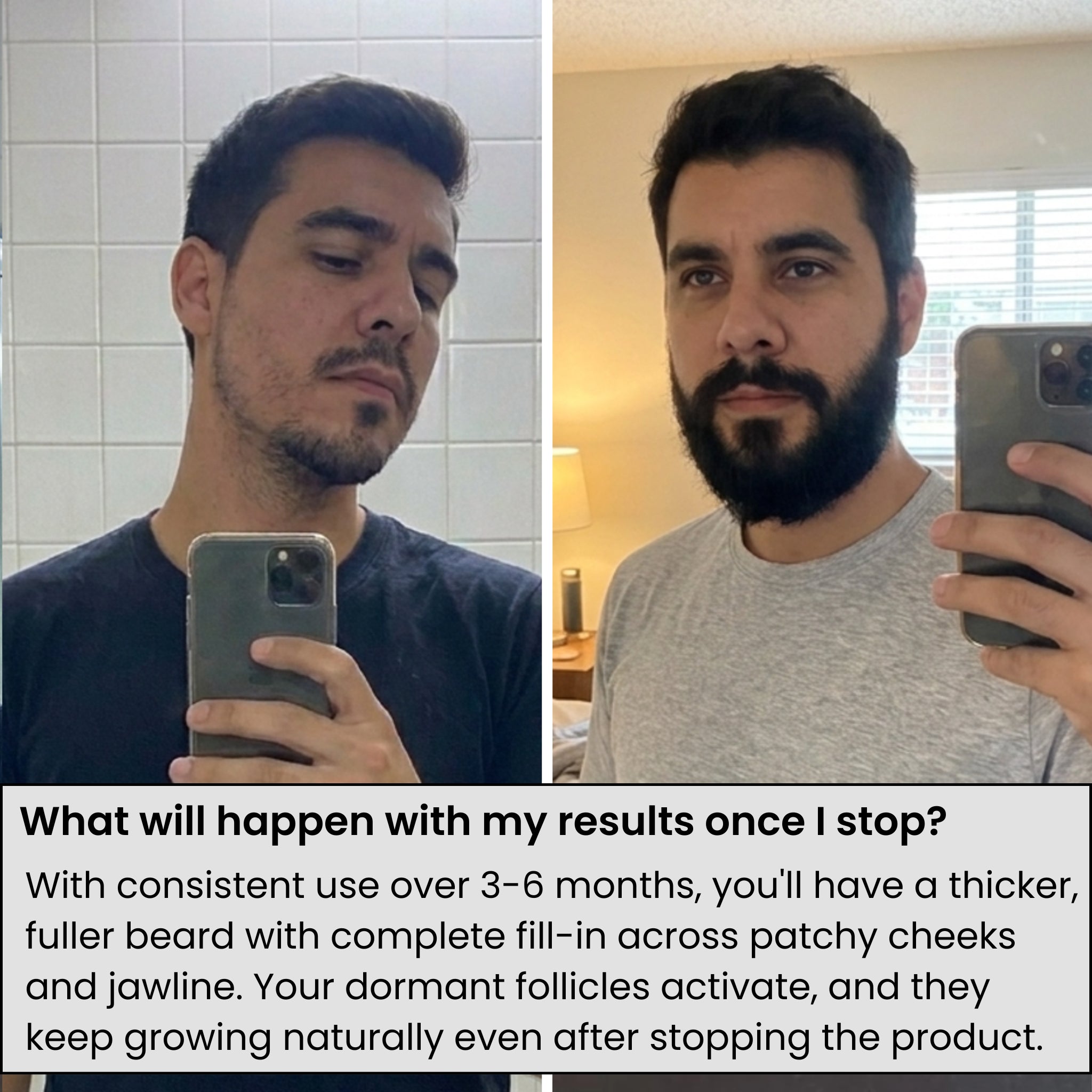 AlphaVance™ Beard Growth System