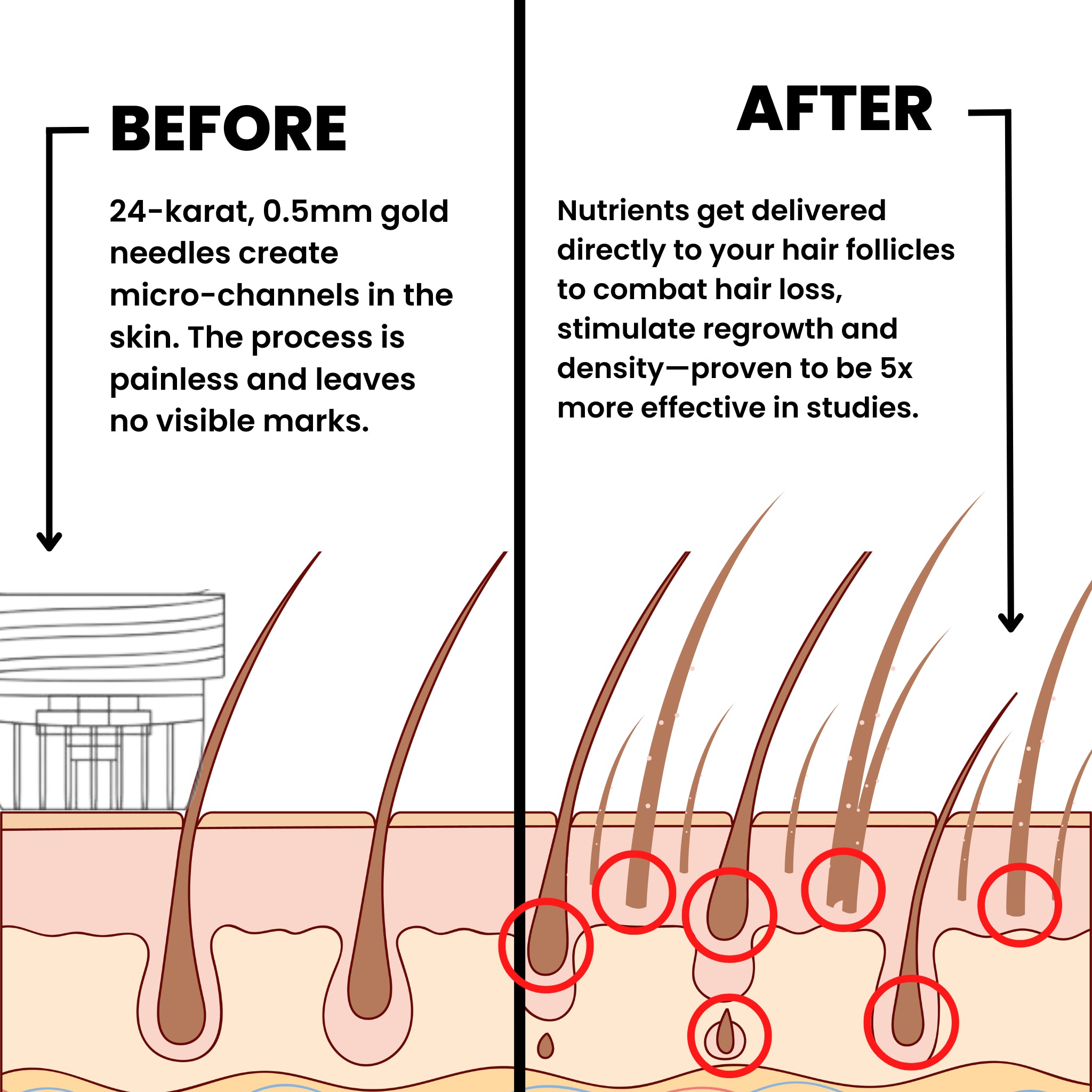 AlphaVance™ Hair Growth System
